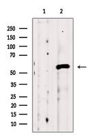 TCP-1 beta Antibody in Western Blot (WB)