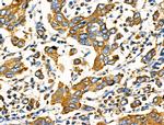 Cripto Antibody in Immunohistochemistry (Paraffin) (IHC (P))