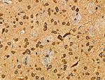 Cripto Antibody in Immunohistochemistry (Paraffin) (IHC (P))