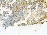 TDP1 Antibody in Immunohistochemistry (Paraffin) (IHC (P))