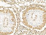 TEAD2 Antibody in Immunohistochemistry (Paraffin) (IHC (P))