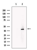 TNMD Antibody in Western Blot (WB)