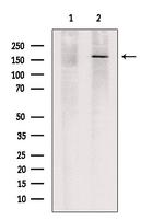 TET3 Antibody in Western Blot (WB)