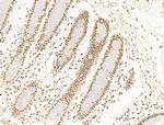 TFAP4 Antibody in Immunohistochemistry (Paraffin) (IHC (P))