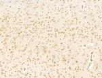 TFAP4 Antibody in Immunohistochemistry (Paraffin) (IHC (P))