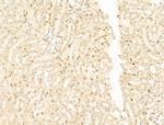 TFAP4 Antibody in Immunohistochemistry (Paraffin) (IHC (P))