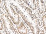 TFAP4 Antibody in Immunohistochemistry (Paraffin) (IHC (P))