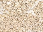 TFAP4 Antibody in Immunohistochemistry (Paraffin) (IHC (P))