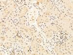 TFAP4 Antibody in Immunohistochemistry (Paraffin) (IHC (P))