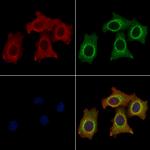 TFPI Antibody in Immunocytochemistry (ICC/IF)