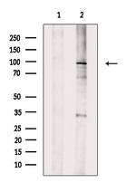 TGFBR3 Antibody in Western Blot (WB)