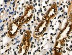 PAR1 Antibody in Immunohistochemistry (Paraffin) (IHC (P))