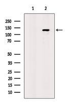 CD202b (TIE2) Antibody in Western Blot (WB)