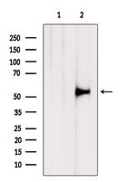 TMPRSS2 Antibody in Western Blot (WB)