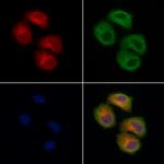 TOM1L2 Antibody in Immunocytochemistry (ICC/IF)