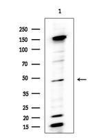 5T4 Antibody in Western Blot (WB)