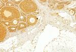 Transferrin Receptor Antibody in Immunohistochemistry (Paraffin) (IHC (P))