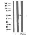 Transferrin Receptor Antibody in Western Blot (WB)