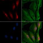 TNPO1 Antibody in Immunocytochemistry (ICC/IF)