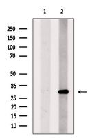 TREM2 Antibody in Western Blot (WB)