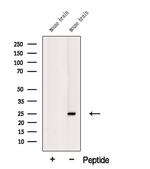 TREM2 Antibody in Western Blot (WB)