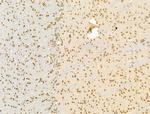 ZFP36 Antibody in Immunohistochemistry (Paraffin) (IHC (P))