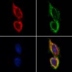 TSC1 Antibody in Immunocytochemistry (ICC/IF)