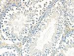 TSC1 Antibody in Immunohistochemistry (Paraffin) (IHC (P))