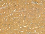 TSC1 Antibody in Immunohistochemistry (Paraffin) (IHC (P))