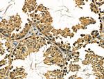 TSC1 Antibody in Immunohistochemistry (Paraffin) (IHC (P))