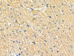 TSC1 Antibody in Immunohistochemistry (Paraffin) (IHC (P))