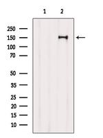 TSC1 Antibody in Western Blot (WB)