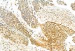 TSG101 Antibody in Immunohistochemistry (Paraffin) (IHC (P))