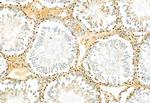 TSG101 Antibody in Immunohistochemistry (Paraffin) (IHC (P))