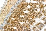 TSG101 Antibody in Immunohistochemistry (Paraffin) (IHC (P))