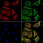 TSH Receptor Antibody in Immunocytochemistry (ICC/IF)