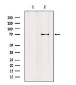 TSH Receptor Antibody in Western Blot (WB)