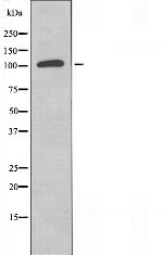 GCP5 Antibody in Western Blot (WB)