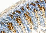 TrxR1 Antibody in Immunohistochemistry (Paraffin) (IHC (P))