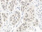 UBR4 Antibody in Immunohistochemistry (Paraffin) (IHC (P))