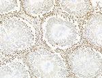 UBR4 Antibody in Immunohistochemistry (Paraffin) (IHC (P))