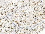 UBR4 Antibody in Immunohistochemistry (Paraffin) (IHC (P))