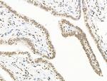 UBR4 Antibody in Immunohistochemistry (Paraffin) (IHC (P))