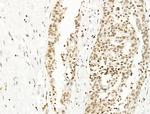 UBR4 Antibody in Immunohistochemistry (Paraffin) (IHC (P))