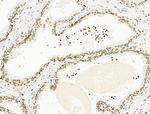 UBR4 Antibody in Immunohistochemistry (Paraffin) (IHC (P))