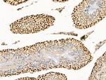 UBR4 Antibody in Immunohistochemistry (Paraffin) (IHC (P))