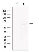 UGT1A6 Antibody in Western Blot (WB)