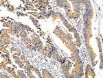 VDAC2 Antibody in Immunohistochemistry (Paraffin) (IHC (P))