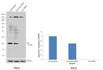 VHL Antibody in Western Blot (WB)