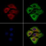 WISP2 Antibody in Immunocytochemistry (ICC/IF)